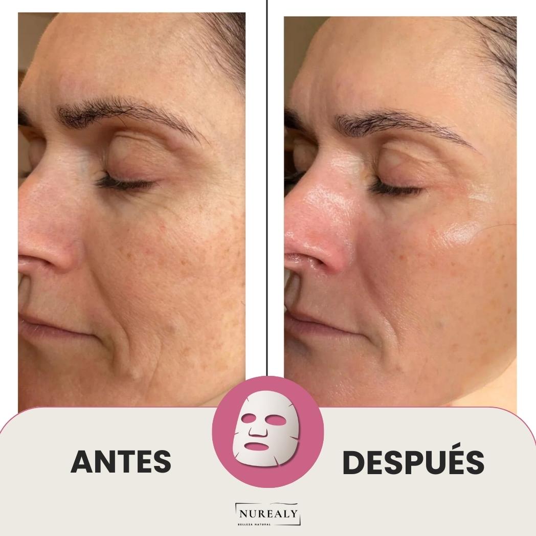 Tratamiento 5 Mascarillas de Bio-Cólageno