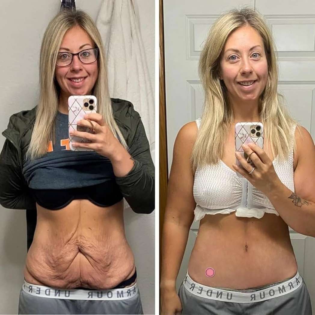 Parches GLP-1 (30 Parches + 30 Gratis)