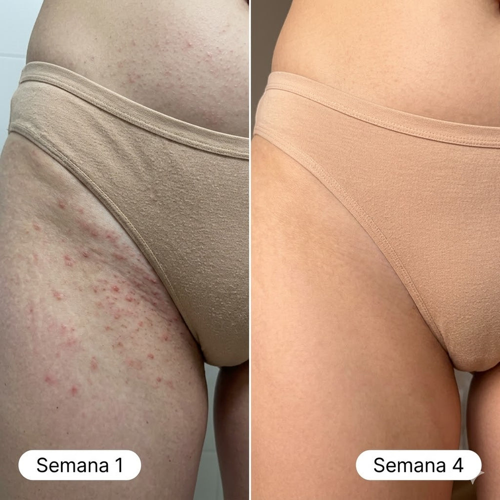 <h2>Resultados Reales, Testimonios Aprobados por <strong>+10,000 Mujeres Satisfechas</strong></h2>