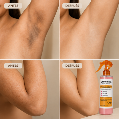 Nurealy Peel Shot - Spray exfoliante corporal con ácido kójico