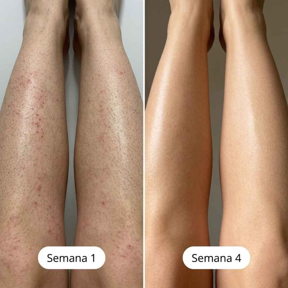 <h2>Resultados Reales, Testimonios Aprobados por <strong>+10,000 Mujeres Satisfechas</strong></h2>