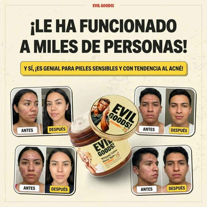 Elimina las Arrugas e Hidrata en 7 Días