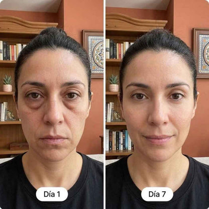 Nurealy - Gel Tensor de Ojos Resultados Desde el Primer Uso