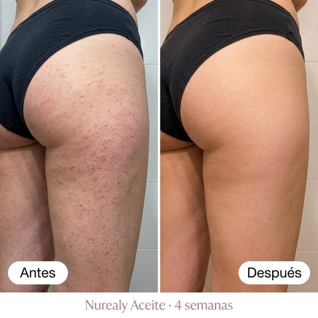 Nurealy™ Aceite Regenerador Post-Depilación