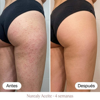 Nurealy™ Aceite Regenerador Post-Depilación