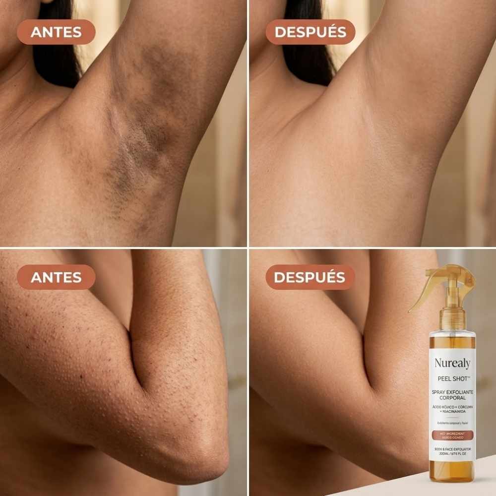 Nurealy Peel Shot - Spray exfoliante corporal con ácido kójico