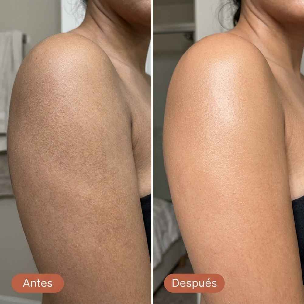 <p>RESULTADOS REALES DE CLIENTAS REALES</p>