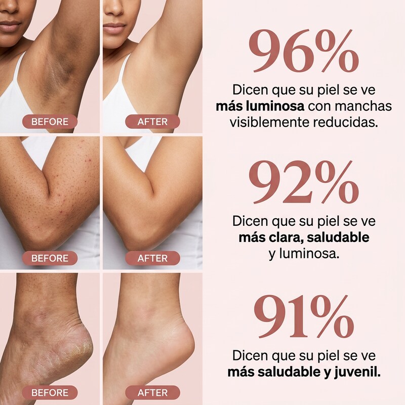 Nurealy Peel Shot - Spray exfoliante corporal con ácido kójico