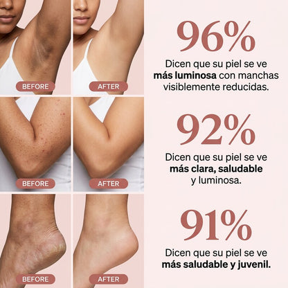 Nurealy Peel Shot - Spray exfoliante corporal con ácido kójico